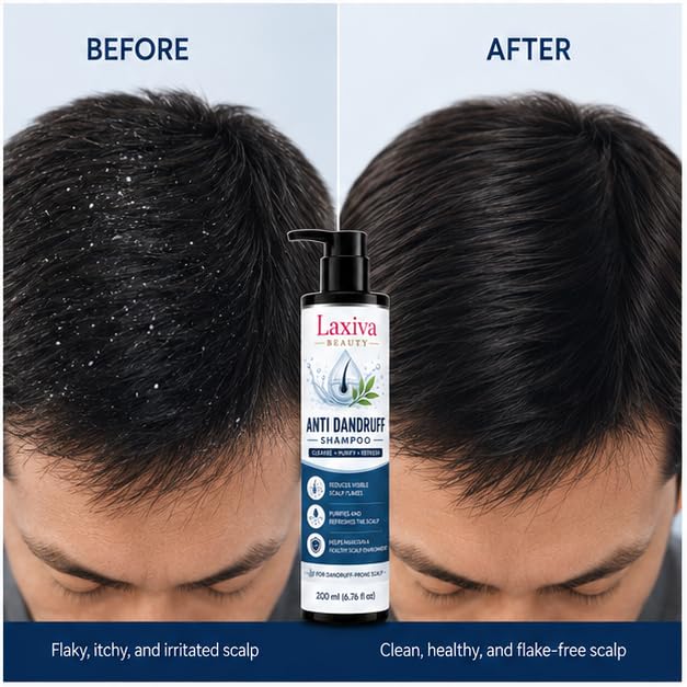 Laxiva Beauty Anti Dandruff Shampoo for Daily Hair & Scalp Cleansing, Refreshing Shampoo for Dandruff-Prone Scalp, Gentle Formula, Suitable for All Hair Types, 200ml