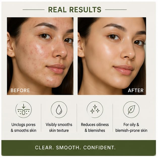 Laxiva Beauty 1% Salicylic Acid Face Serum for Oily & Blemish-Prone Skin, Lightweight Facial Serum for Daily Skincare, Fast-Absorbing Formula, 30ml