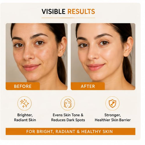 Laxiva Beauty 10% Vitamin C Face Serum for Daily Skincare, Lightweight Facial Serum for Radiance-Looking Skin, Fast-Absorbing Formula, All Skin Types, 30ml